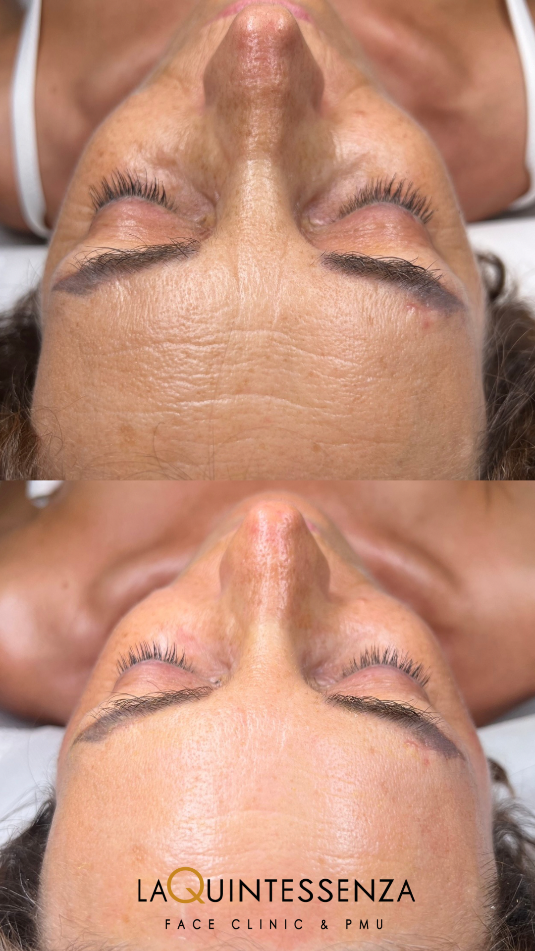 La Quintessenza Face clinic & pmu